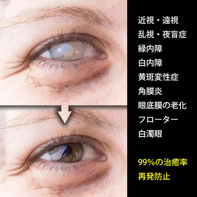 アイケア目薬 アイケア目薬